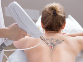 Top 5 How To Choose a Good Laser Tattoo Removal Clinic